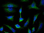 LDHA Antibody in Immunocytochemistry (ICC/IF)