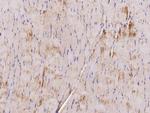 LDHA Antibody in Immunohistochemistry (Paraffin) (IHC (P))