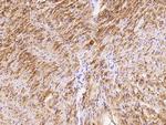 GLUT4 Antibody in Immunohistochemistry (Paraffin) (IHC (P))