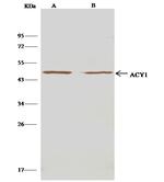 Aminoacylase Antibody in Immunoprecipitation (IP)