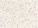 Carbonic Anhydrase II Antibody in Immunohistochemistry (Paraffin) (IHC (P))