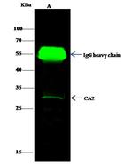 Carbonic Anhydrase II Antibody in Immunoprecipitation (IP)