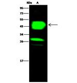 CHIL3 Antibody in Western Blot (WB)