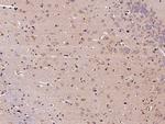 CNDP1 Antibody in Immunohistochemistry (Paraffin) (IHC (P))