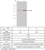 EVI2B Antibody in Immunoprecipitation (IP)