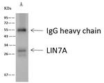 LIN7A Antibody in Immunoprecipitation (IP)