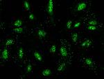 NUP107 Antibody in Immunocytochemistry (ICC/IF)