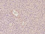 PIK3CG Antibody in Immunohistochemistry (Paraffin) (IHC (P))