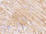 PIK3CG Antibody in Immunohistochemistry (Paraffin) (IHC (P))