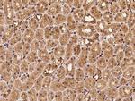 Profilin 1 Antibody in Immunohistochemistry (Paraffin) (IHC (P))