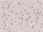 GP130 Antibody in Immunohistochemistry (Paraffin) (IHC (P))