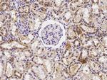 GP130 Antibody in Immunohistochemistry (Paraffin) (IHC (P))