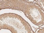 NPC2 Antibody in Immunohistochemistry (Paraffin) (IHC (P))