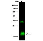 NPC2 Antibody in Western Blot (WB)