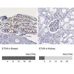 ETV6 Antibody