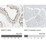 BNIP1 Antibody