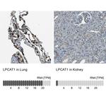 LPCAT1 Antibody