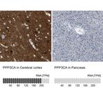 Calcineurin A Antibody