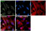 DCP1A Antibody in Immunocytochemistry (ICC/IF)