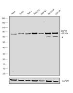 DCP1A Antibody in Western Blot (WB)