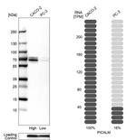 CALM Antibody