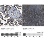 SLC4A2 Antibody