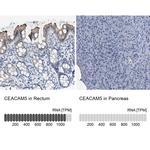 CEA Antibody