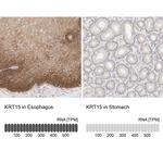 Cytokeratin 15 Antibody