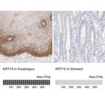 Cytokeratin 15 Antibody