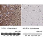 AKR1B1 Antibody