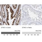 ETHE1 Antibody