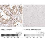 GGPS1 Antibody