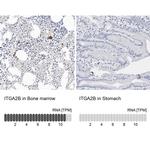 CD41 Antibody