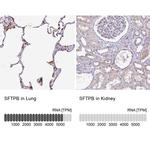 SFTPB Antibody