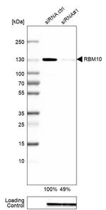 RBM10 Antibody