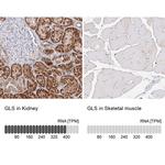 Glutaminase Antibody