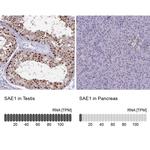 SAE1 Antibody