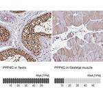 PPP4C Antibody