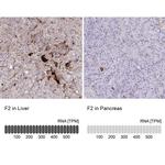 Prothrombin Antibody