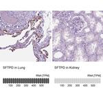 SFTPD Antibody