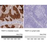 TNNT1 Antibody