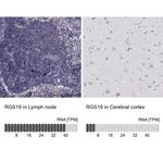 RGS19 Antibody