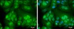 Androgen Receptor Antibody in Immunocytochemistry (ICC/IF)