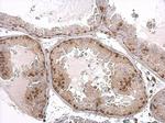 Androgen Receptor Antibody in Immunohistochemistry (Paraffin) (IHC (P))