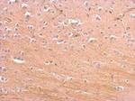 Presenilin 1 Antibody in Immunohistochemistry (Paraffin) (IHC (P))