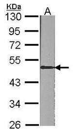 Presenilin 1 Antibody in Western Blot (WB)