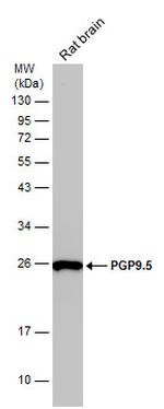 PGP9.5 Antibody in Western Blot (WB)