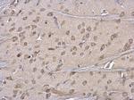 ERP29 Antibody in Immunohistochemistry (Paraffin) (IHC (P))