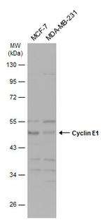 Cyclin E Antibody in Western Blot (WB)