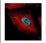 Cyclin E Antibody in Immunocytochemistry (ICC/IF)